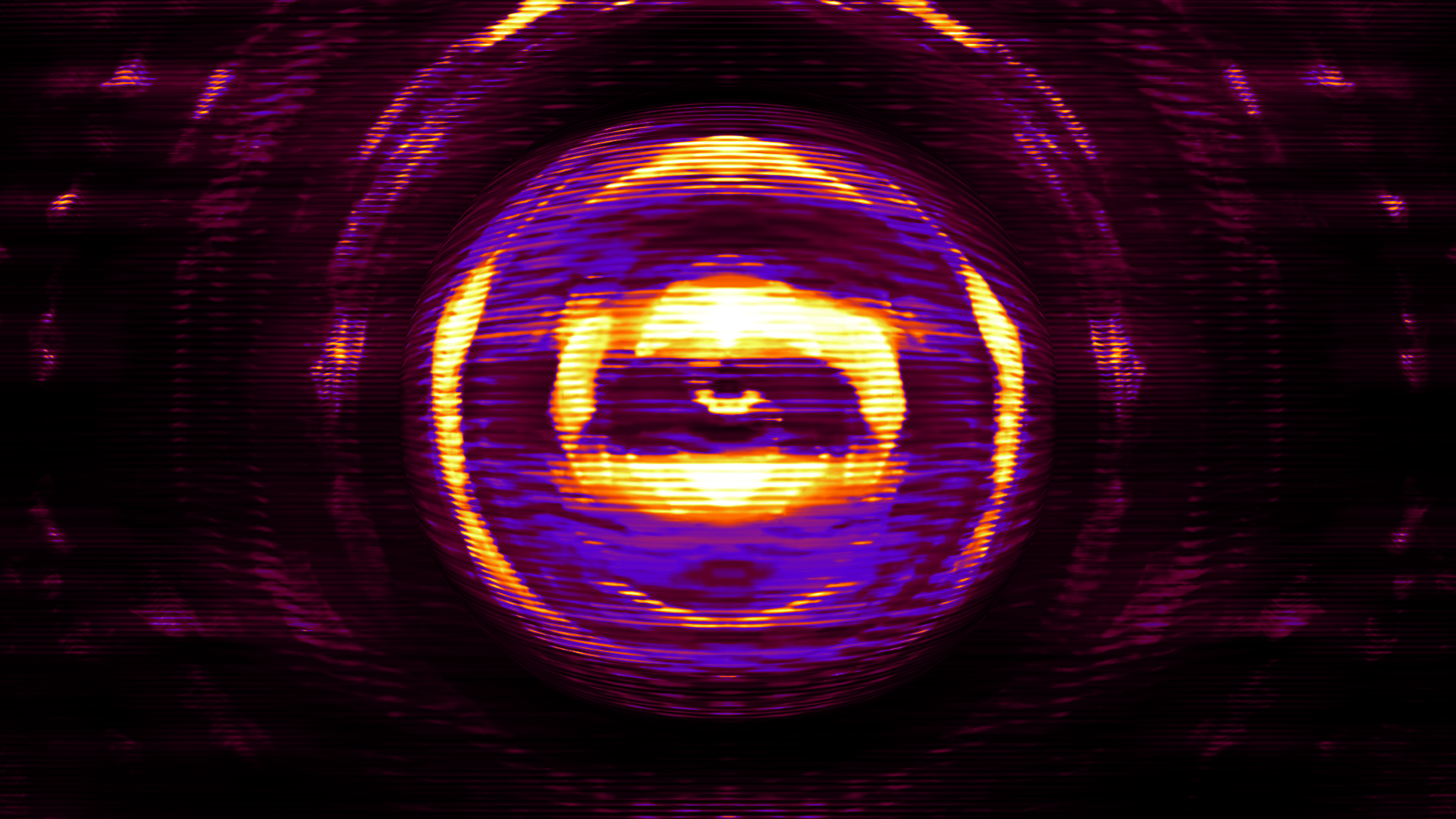 Gazer